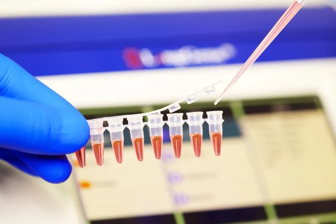 Hvordan velge PCR/qPCR forbruksvarer?